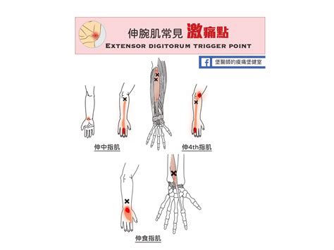 大拇指指節|手肘痛、手腕痛、手指痛的原因,治療與自我檢查 » 台。